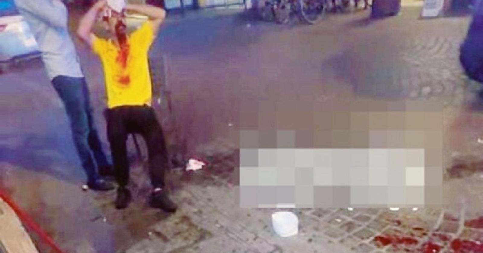 Sfregiato a bottigliate: “Ora ho paura”