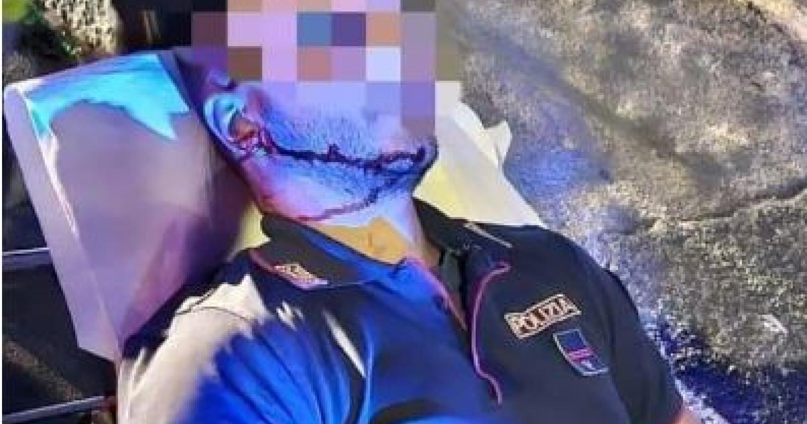 Aggredito con la forchetta, poliziotto finisce in ospedale