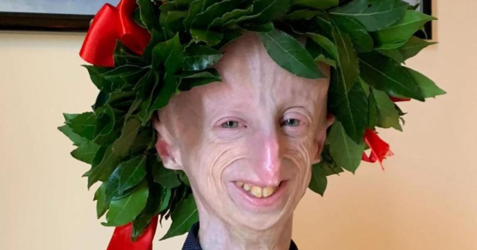 Addio a Sammy Basso: L'Eroe della Progeria e il Suo Impatto Duraturo