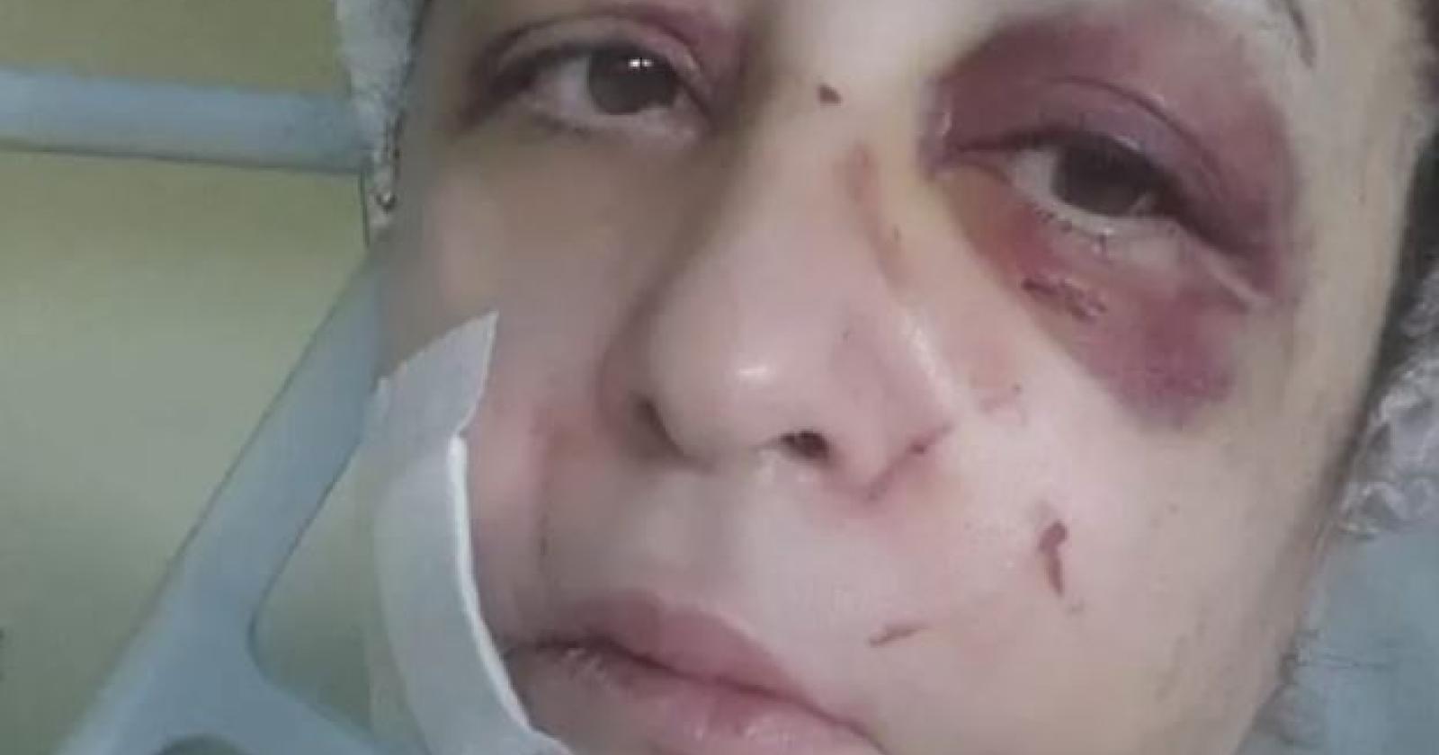 La storia di Sandra Pegoraro: sopravvissuta a un femminicidio, vittima di un tragico incidente