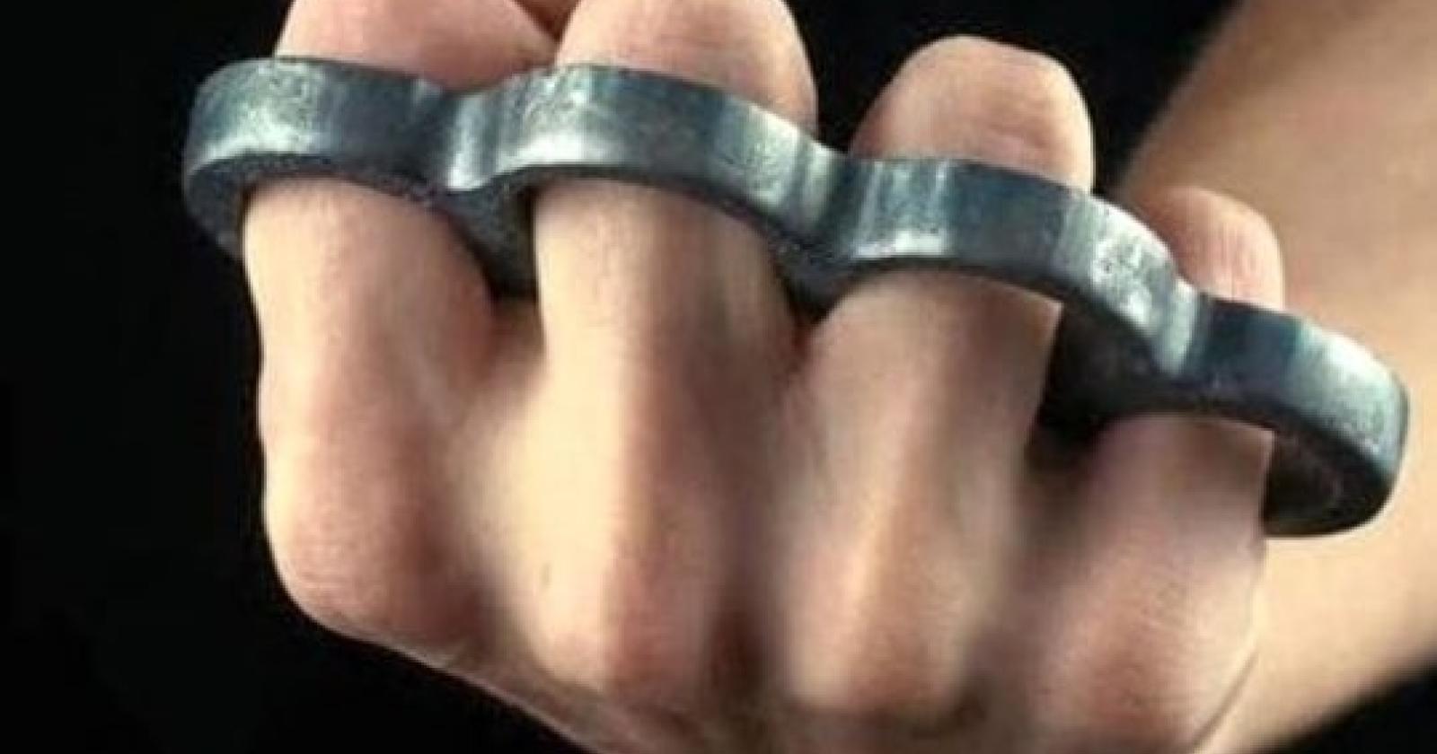 Aggressione brutale a Treviso: pensionato ferito gravemente da un ladro