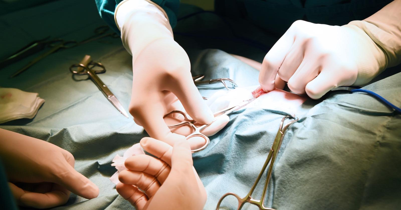 Carcinoma della cervice: una sfida globale ancora aperta