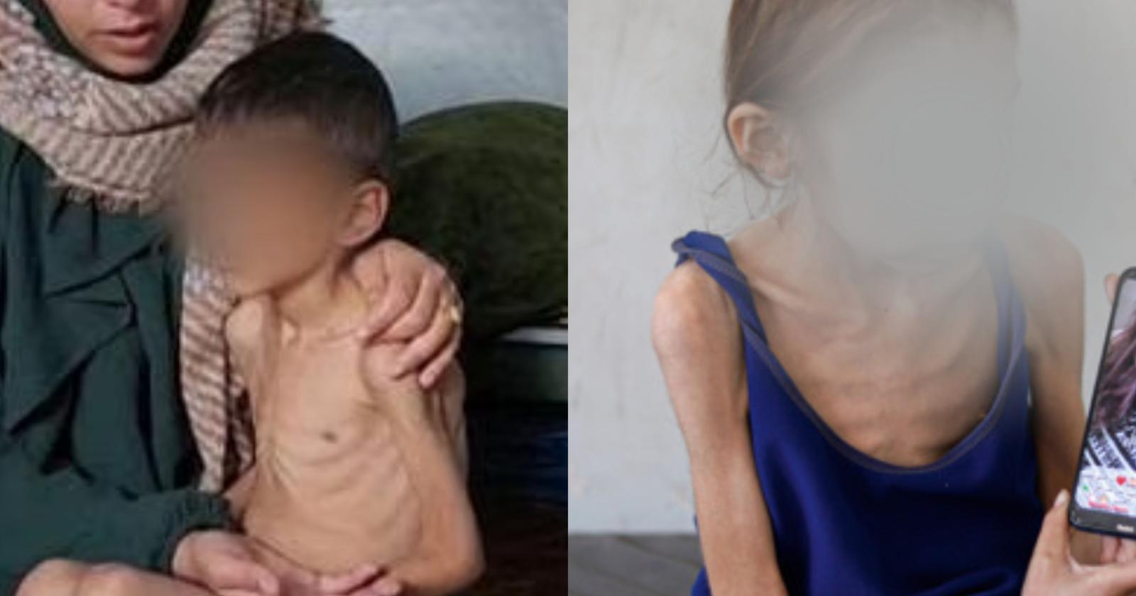 La crisi umanitaria a Gaza: accuse di genocidio e complicità internazionale