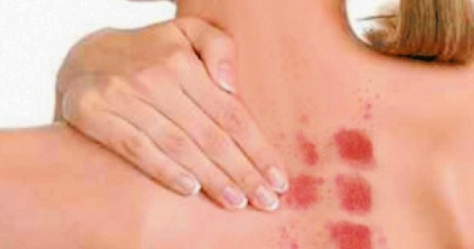 Odissea per trovare un allergologo