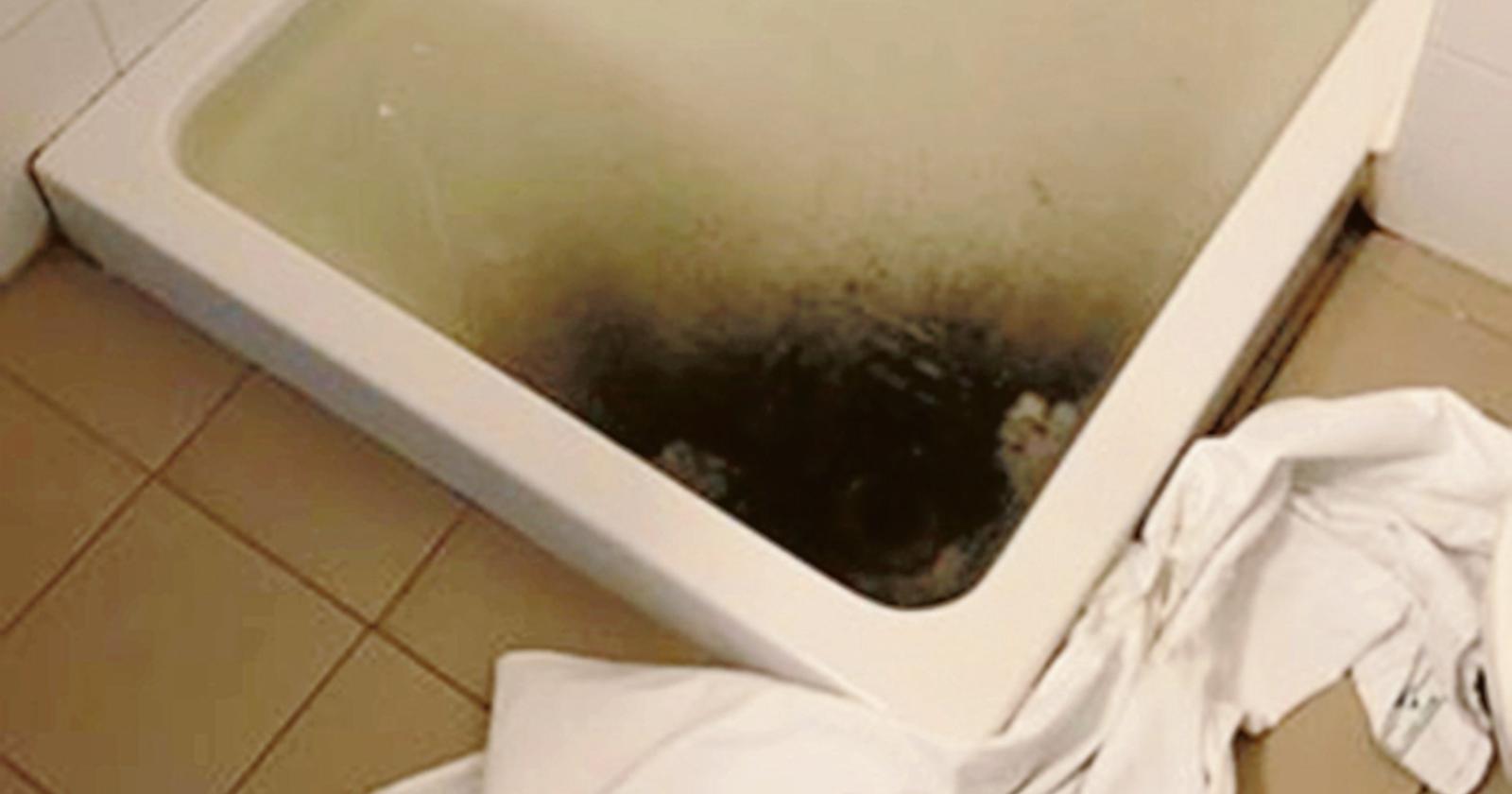 Incredibile: in ospedale esce acqua nera dalla doccia