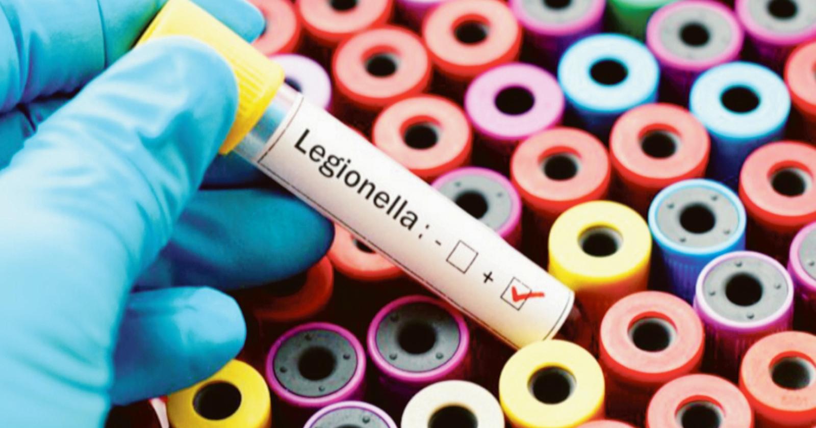 Scatta la guerra alla legionella