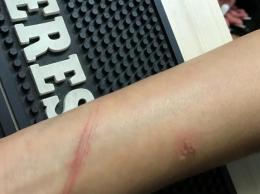 Tentato stupro alle giostre. L'aggressore rischia il linciaggio 