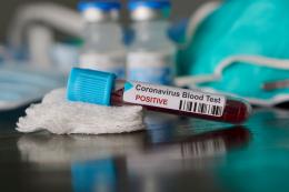 Nuovo contagio a Vo' nel focolaio che pareva spento