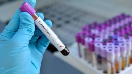 Curarsi col plasma: partono i prelievi ai Veneti guariti