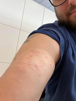 Arrestato il nigeriano che ha aggredito il vicesindaco