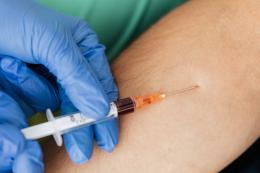 Sino a un mese di attesa per gli esami del sangue