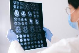 Alice, screening gratuito contro l'ictus