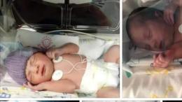 Forza piccola Chloe! Nata prematura, salvata dai medici