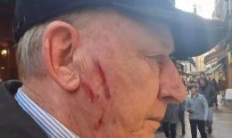 Sventa il furto, aggredito e ferito dalle giovani ladre