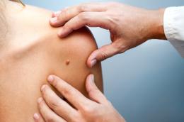 Visite dermatologiche gratuite per gli over 60