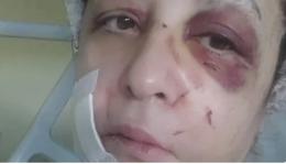 Sandra vittima di un incidente, era sfuggita al femminicidio