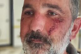 "Aggredito e picchiato perché gay"