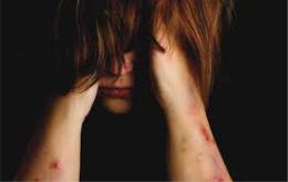 Aumentano i casi di autolesionismo