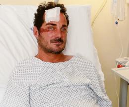 Indagato per lesioni e omissione di soccorso