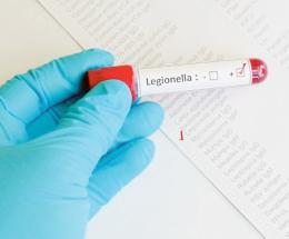 Legionella, tubature sotto accusa