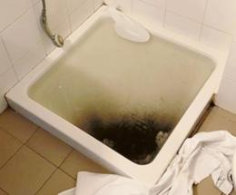 Incredibile: in ospedale esce acqua nera dalla doccia