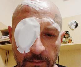Una brutale aggressione ai danni del titolare di un centro benessere