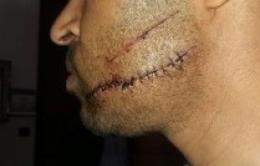 Accoltella al volto un connazionale, ma è già libero