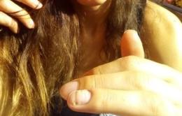 Fa la manicure, si infetta le dita della mano e la sua vita è rovinata