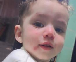 Morto a due anni, la denuncia dei genitori