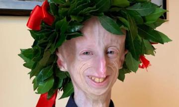 Inaugurato l'asilo Sammy Basso